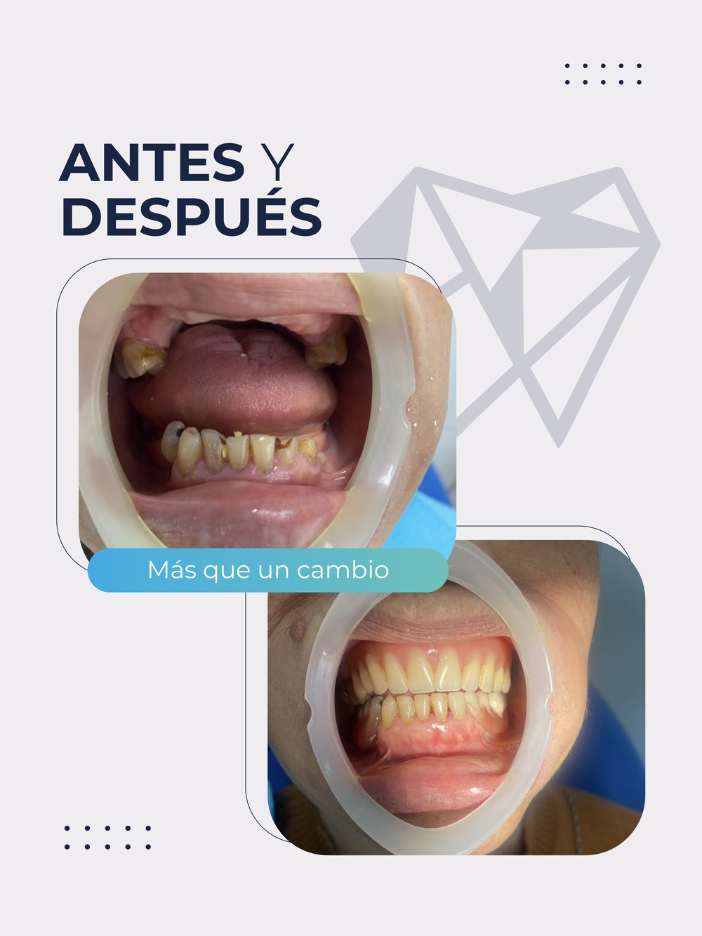 Antes y después del tratamiento — caso 1