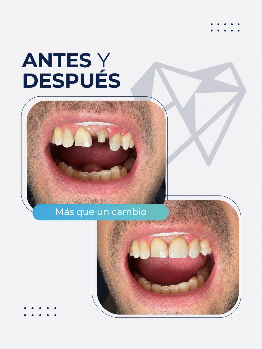 Antes y después del tratamiento — caso 2